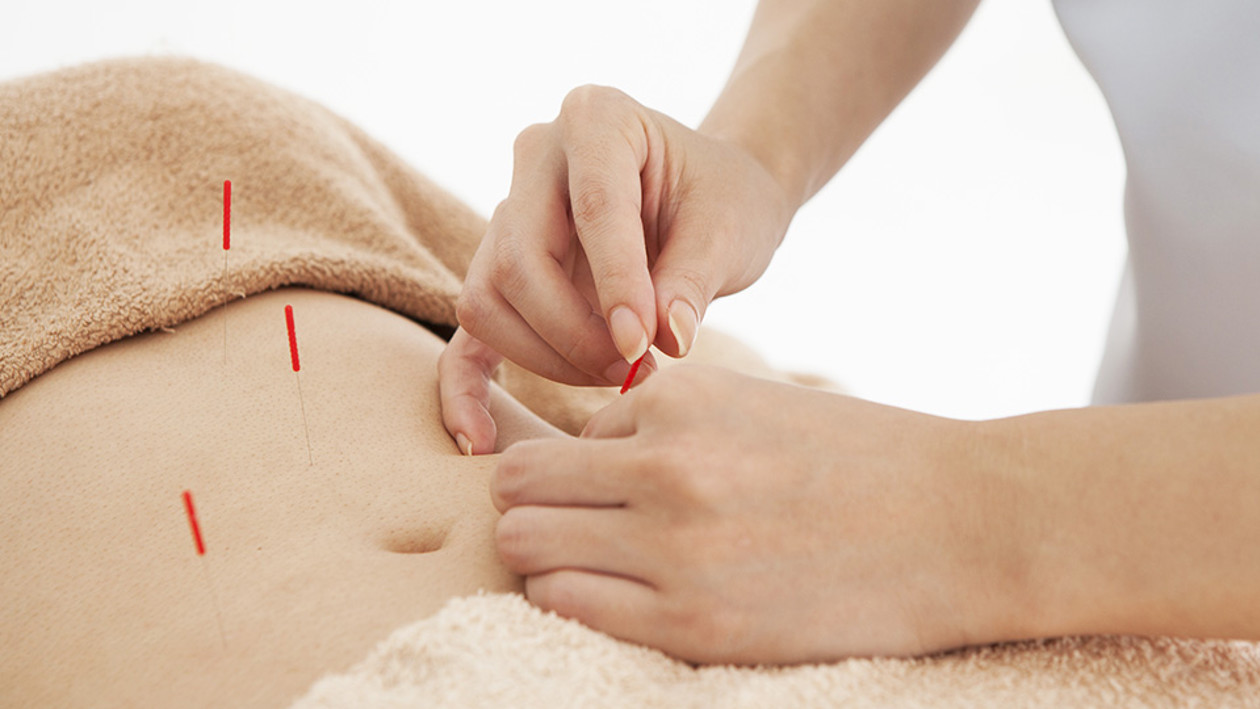 Chinese Medicine Weight Management Package (10 sessions) 