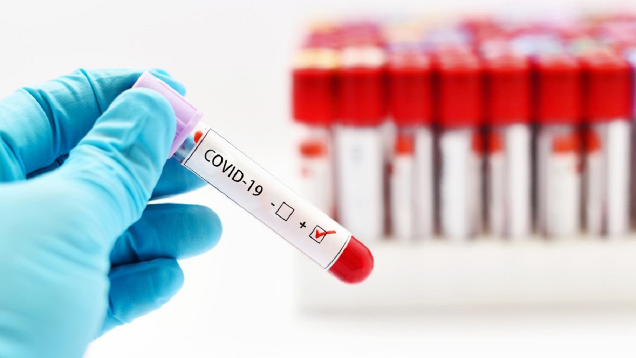 COVID19 Vaccine Antibodies Test (IgG II Quantitative & Neutralising