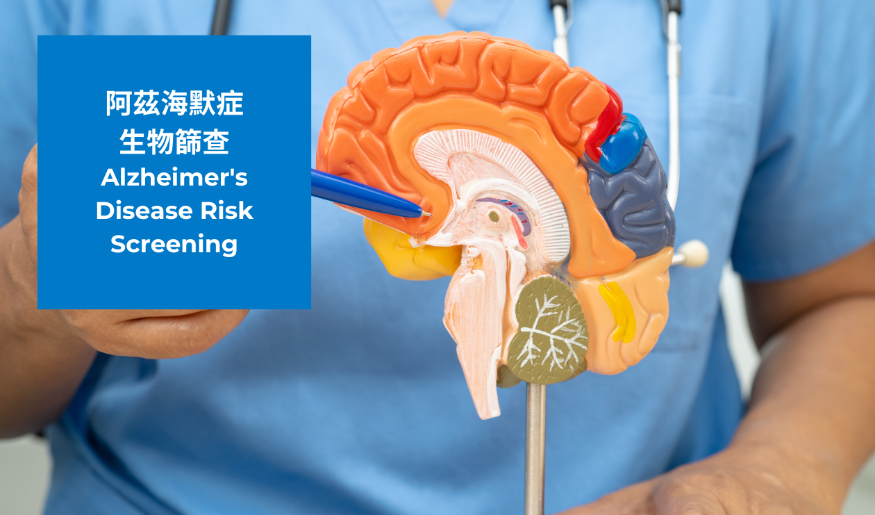 Alzheimer's Disease Risk Screening